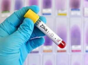 Zika sample